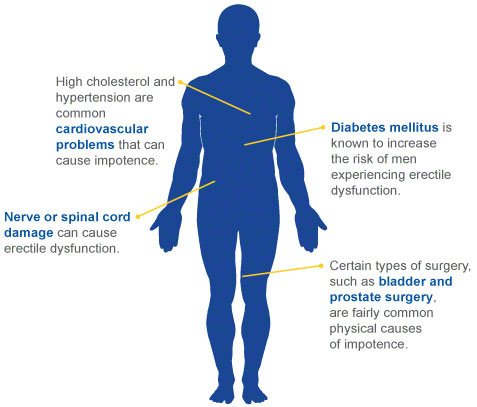 Common causes of low testosterone